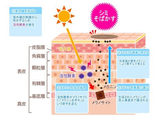 シミ 雀斑